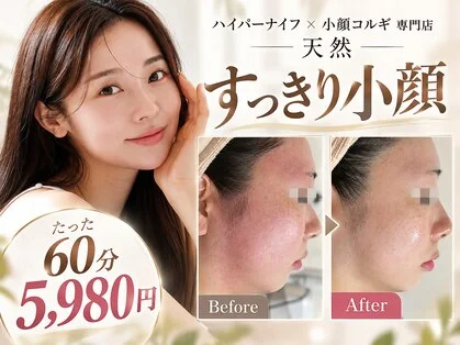 フェイスラインが見える女性の横顔を施術前後で比較した写真