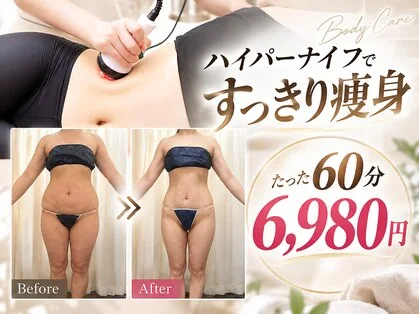 痩身エステの施術前後でウエストまわりの変化を比較した写真
