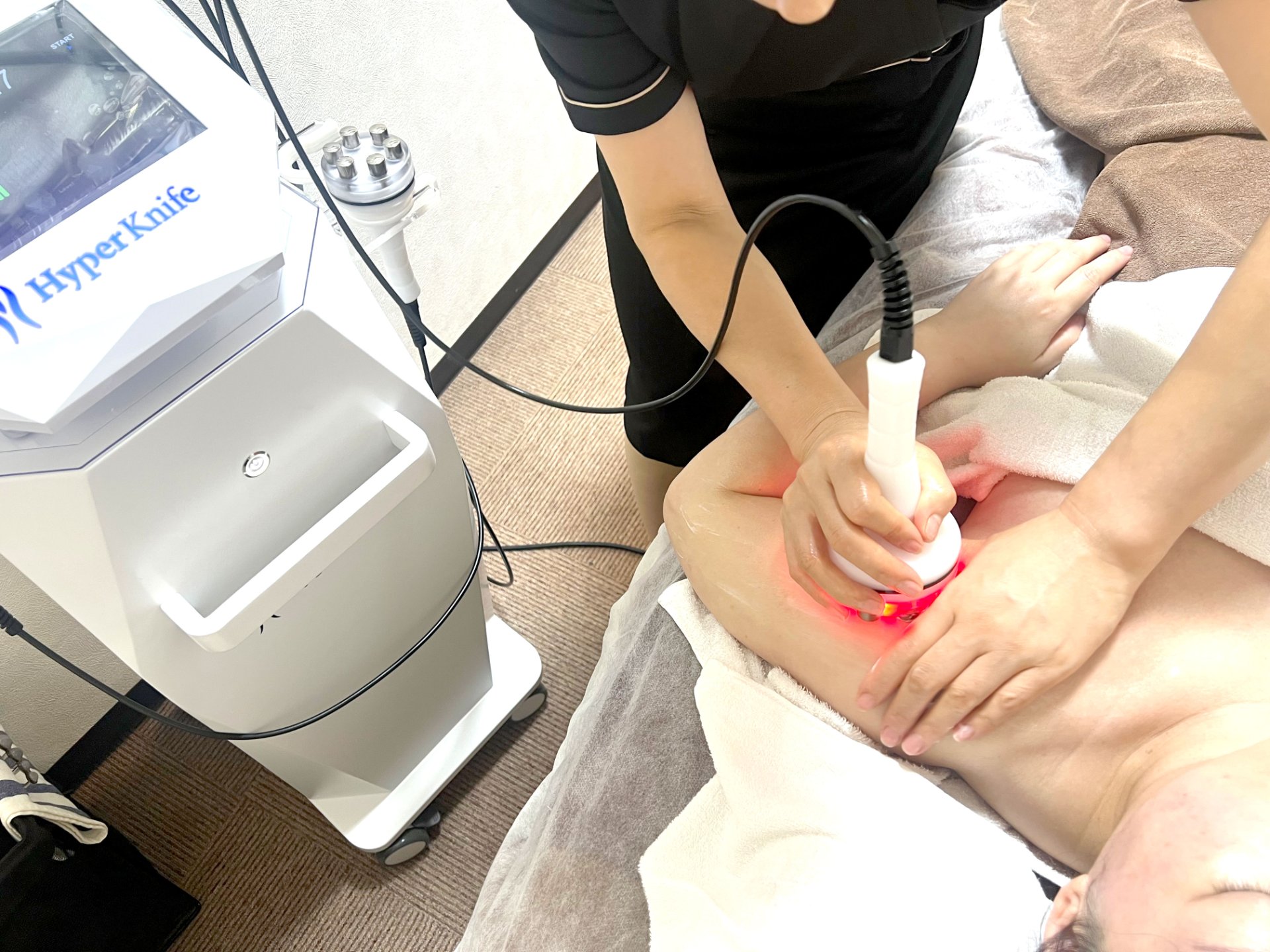 ハイパーナイフの施術機器を使って、お腹まわりを丁寧にケアする施術の様子
